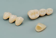 歯の特徴づけ