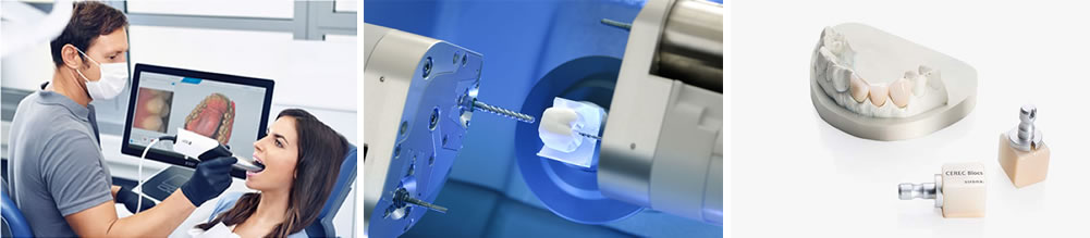 セレックを用いた1Dayトリートメント